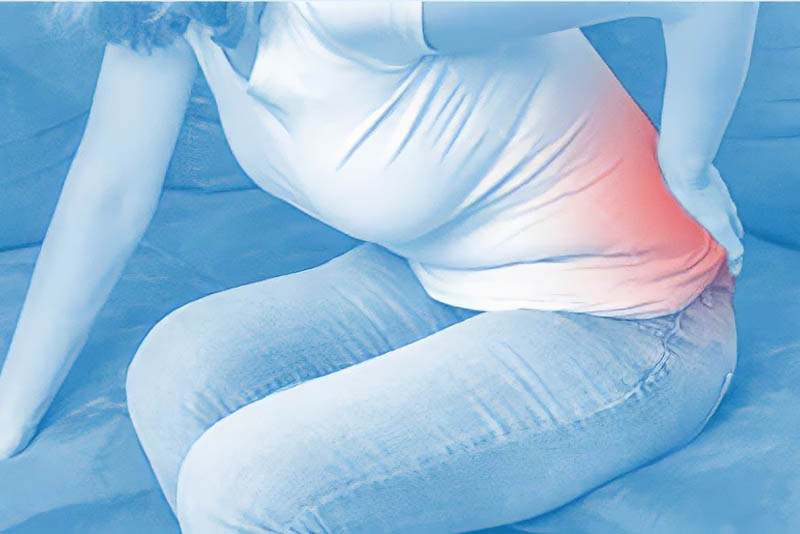 Pain radiating from a woman's lower back